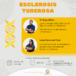 EVENTO GRATUITO – Hablaremos de Esclerosis Tuberosa