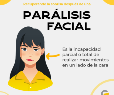 Parálisis Facial – ¿Qué es? ¿Cuál es el tratamiento?